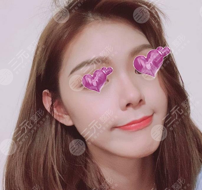 整形医院隆鼻_专业隆鼻整形手术2_整形手术隆鼻专业医院